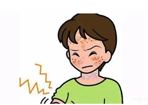 脂溢性皮炎是什么原因引起的？